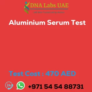 Aluminium Serum Test sale cost 470 AED