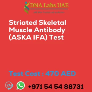 Striated Skeletal Muscle Antibody (ASKA IFA) Test sale cost 470 AED