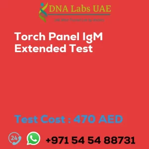 Torch Panel IgM Extended Test sale cost 470 AED