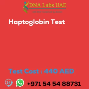 Haptoglobin Test sale cost 440 AED