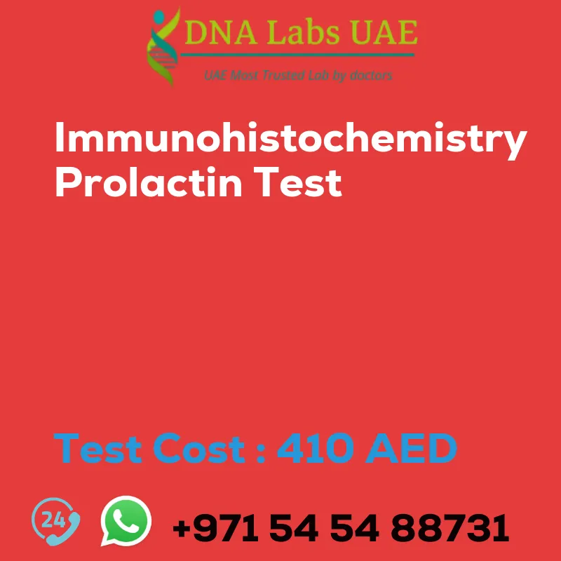 Immunohistochemistry Prolactin Test sale cost 410 AED