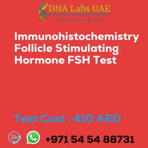 Immunohistochemistry Follicle Stimulating Hormone FSH Test sale cost 410 AED