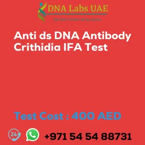 Anti ds DNA Antibody Crithidia IFA Test sale cost 400 AED