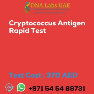 Cryptococcus Antigen Rapid Test sale cost 370 AED
