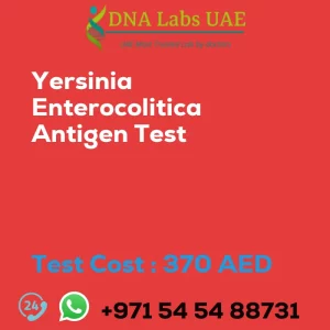 Yersinia Enterocolitica Antigen Test sale cost 370 AED